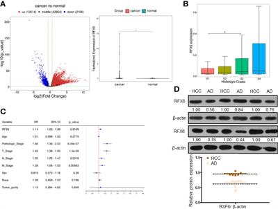 Inhibition of RFX6 Suppresses the Invasive Ability of Tumor Cells Through the Notch Pathway and Affects Tumor Immunity in Hepatocellular Carcinoma